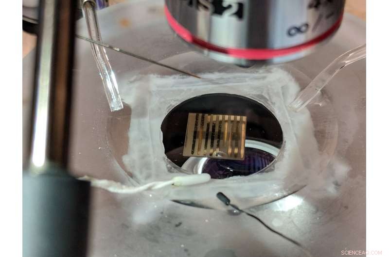 Quantum Sensor Detects Neurological Disorders Early