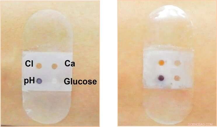 Smart Biosensor Bandage That Collects and Analyzes Sweat for Real-Time Health Insights