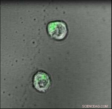 Johns Hopkins Breakthrough: Artificial Lymph Node Gel Triggers Immune Response Against Cancer