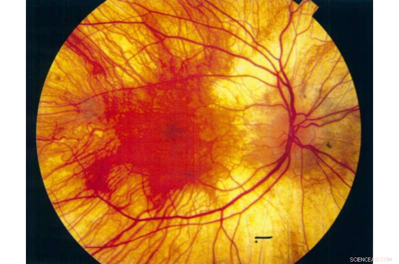 Chemical Probes Unlock New Insights into Disease Development