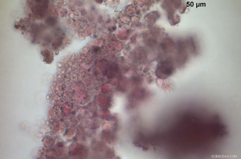 Revolutionary Sensor Detects Spoiled Milk Before Opening