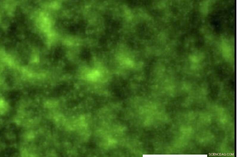 Dual-Action Slippery Catheter Eliminates Bacterial Infections