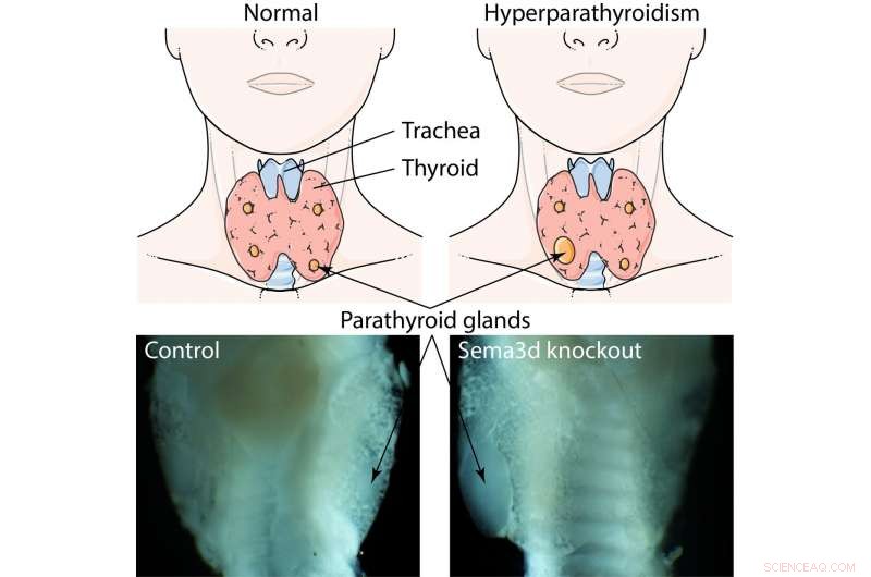 New Signaling Protein Discovery Paves Way for Drug Therapies in Hyperparathyroidism