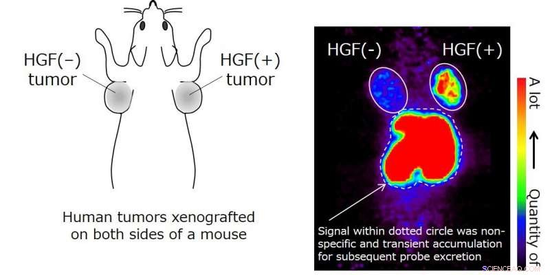 Macrocyclic Peptide Targeting HGF: Mechanisms and Promise in Cancer Theranostics