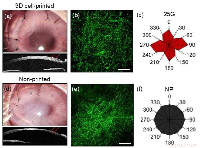 Human‑Like Corneas: 3‑D Printed Artificial Implants Show Promising Results