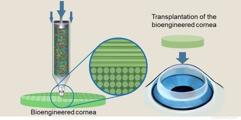 Human‑Like Corneas: 3‑D Printed Artificial Implants Show Promising Results