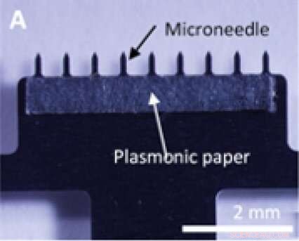 Innovative Painless Skin Patch Collects Interstitial Fluid for Accurate Diagnostic Testing