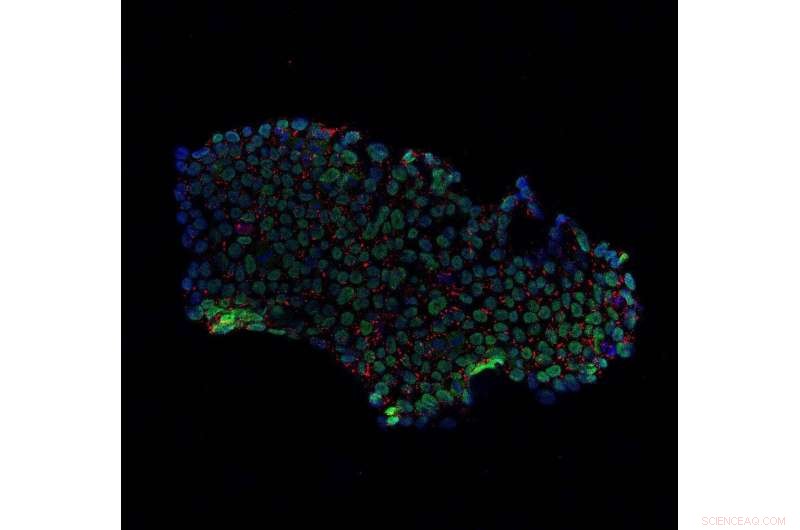 Revolutionizing Stem Cell Therapy: A New Era Begins