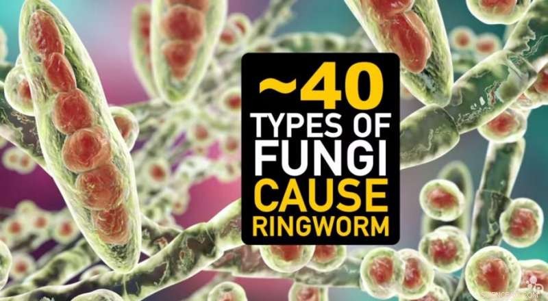 Video: Uncovering the Chemistry Behind Ringworm