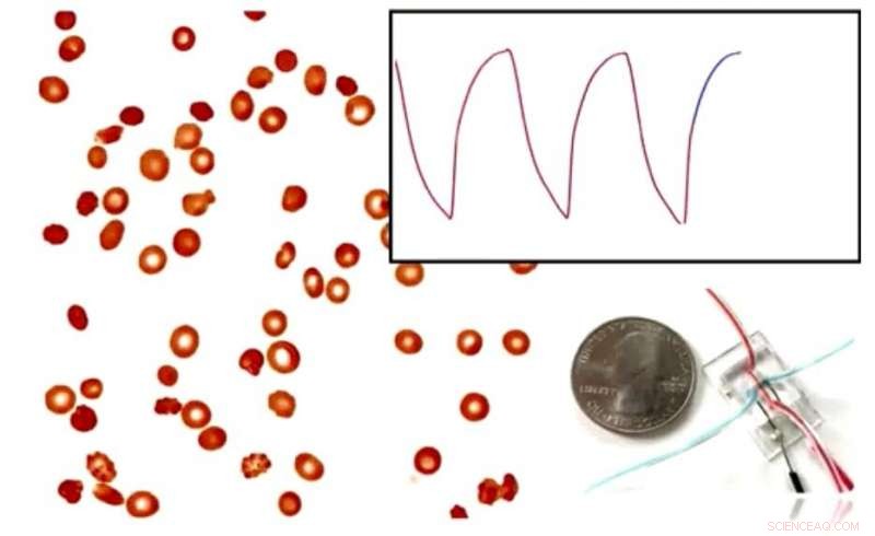 Innovative Technique Enables Rapid, Reliable Monitoring of Sickle Cell Disease