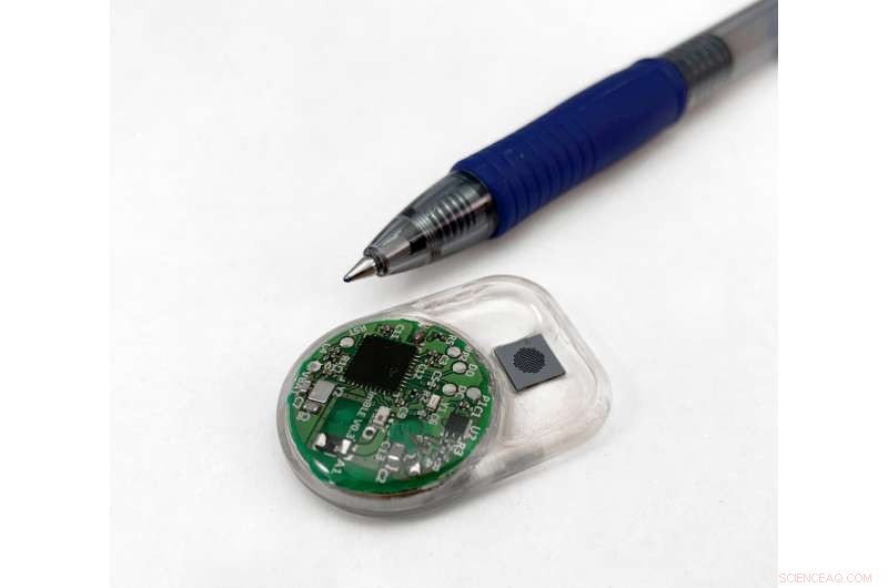 Grape‑Sized Implant for Remote‑Controlled Drug Delivery Could Revolutionize Chronic Disease Care