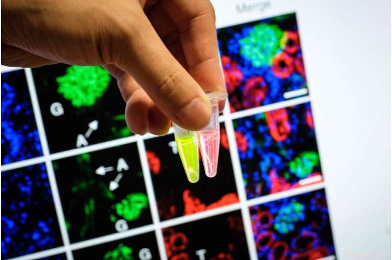 New Urine Probes Enable Rapid Early Detection of Acute Kidney Failure