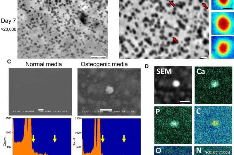 Osteoblastic Lysosomes Drive Bone Mineralization