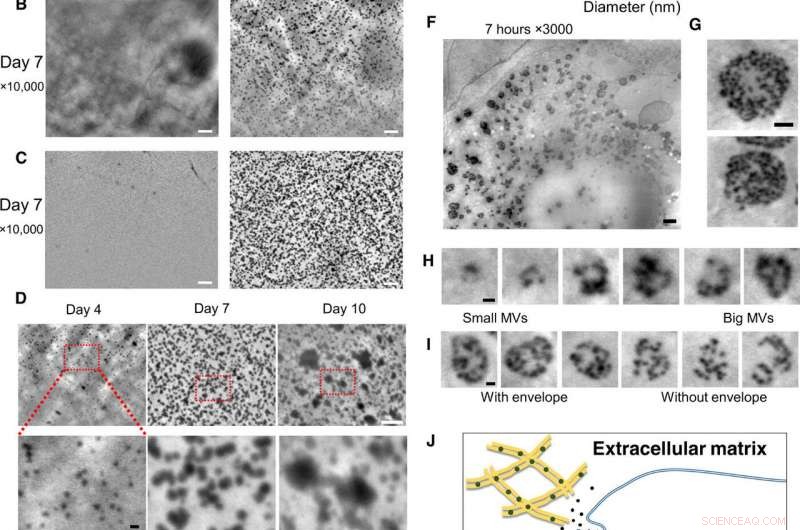 Osteoblastic Lysosomes Drive Bone Mineralization