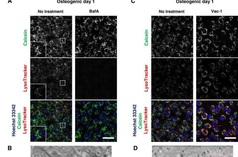 Osteoblastic Lysosomes Drive Bone Mineralization