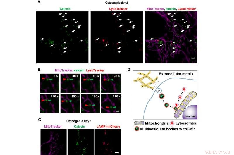 Osteoblastic Lysosomes Drive Bone Mineralization