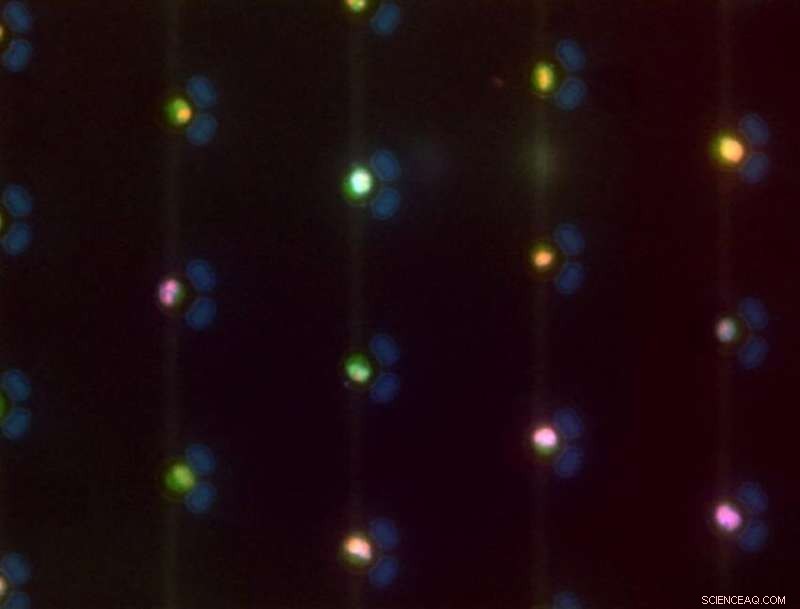 Microfluidic Array Captures Single Cervical Cells for Rapid Screening