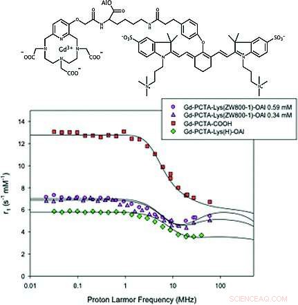 Dual-Mode Contrast Agent Enhances MRI and Other Imaging Techniques