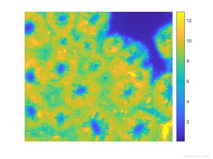 Advanced Chemical Imaging Enhances Colon Cancer Diagnosis