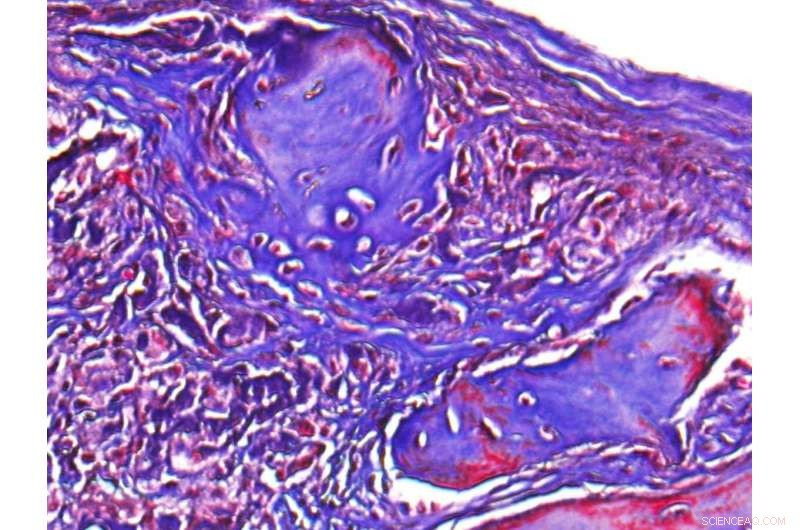 Advanced Porous Hydrogels Show Promise for Bone Defect Repair