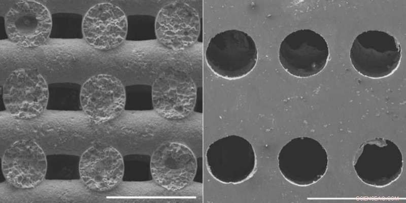 Innovative 3-D Printed Salt Templates Enable Precise, Biodegradable Bone Implants