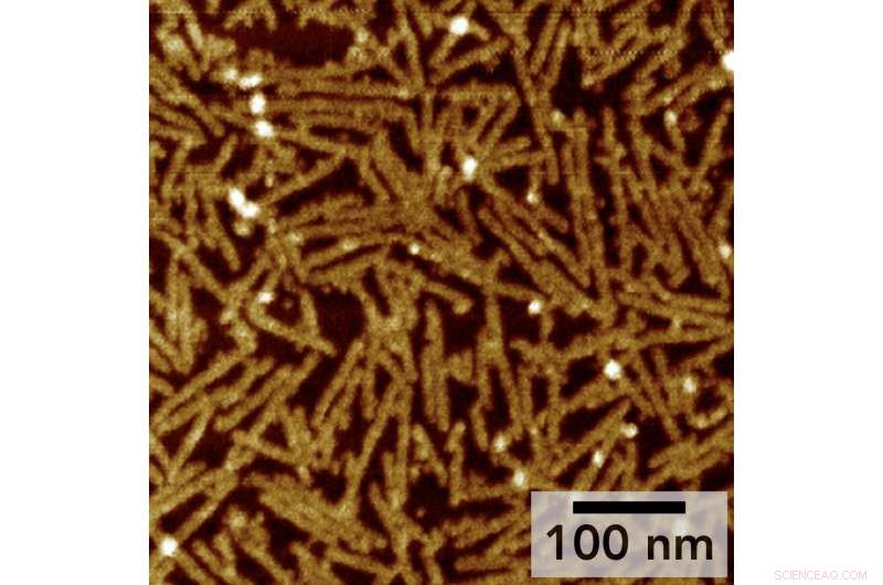 Peptide Hydrogels Show Promise in Healing Traumatic Brain Injuries