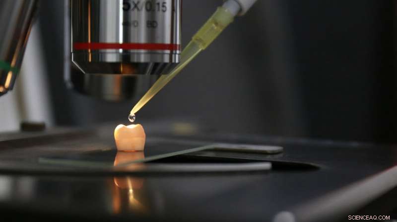 Scientists Discover Novel Technique to Restore Human Tooth Enamel