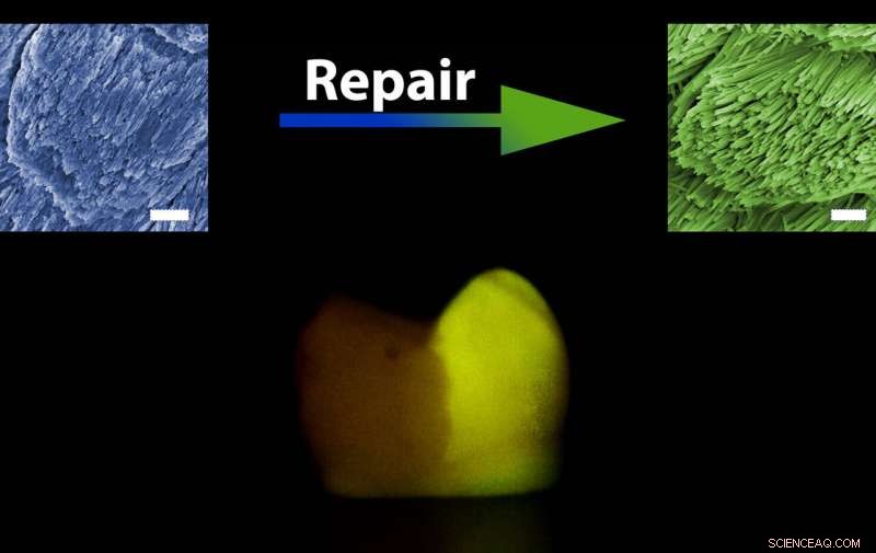 Scientists Discover Novel Technique to Restore Human Tooth Enamel