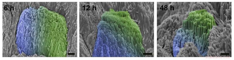 Scientists Discover Novel Technique to Restore Human Tooth Enamel