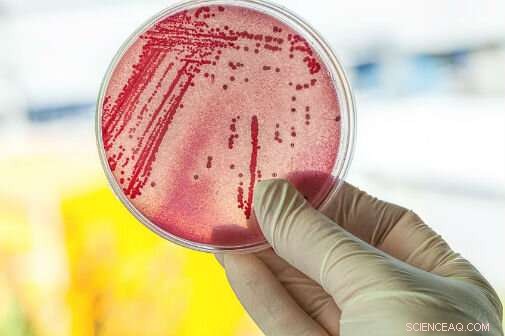 Researchers Develop Rapid Diagnostic Test for Drug-Resistant Infections