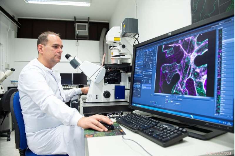 Engineering Plant-Based Oils to Replicate Human Milk Fat for Improved Infant Formula