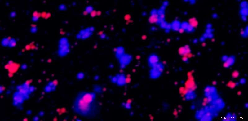 Why Do Liquid Cellular Organelles Stay Separate? Scientists Seek Answers