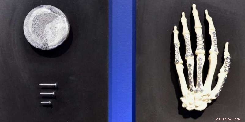 Tracking Corrosion in Bioresorbable Magnesium Alloys at the Nanoscale