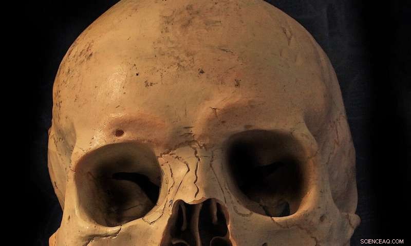 Enhancing Military Helmet Design with Human Skull X‑Ray Analysis