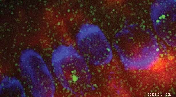 Researchers Discover First Evidence of RNA-Induced Phase Separation