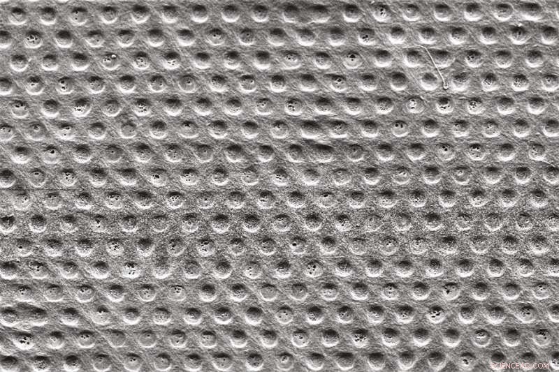 ETH Zurich’s Protective Membrane Reduces Fibrotic Scarring Around Pacemakers