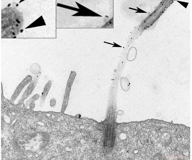 Kidney Cilia Release Ectosomes to Deliver Vital Downstream Signals