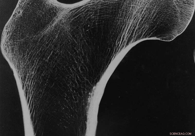 New 3‑D Printing Technique Mimics Human Bone to Create Ultra‑Lightweight, Strong Structures