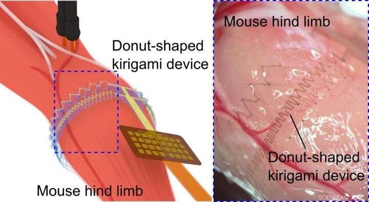 Kirigami-Enabled Electronics for Direct Muscle Integration