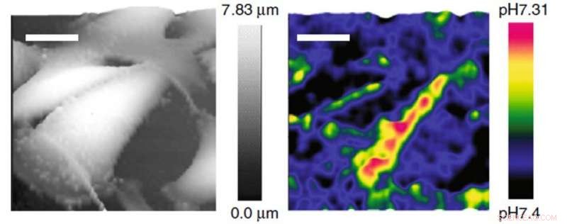 Advanced pH Probes Could Advance Cancer Treatment