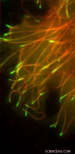 Seeing Taxol in Action: How Advanced Microscopy Unveils Anti‑Cancer Drug Mechanisms