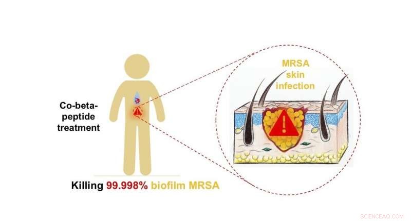 Innovative Polymer Targets and Eliminates Drug-Resistant Bacteria