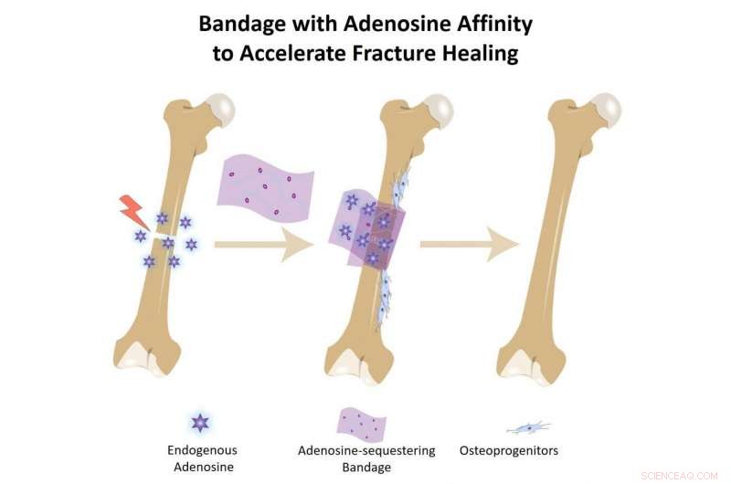 Innovative Bone Bandage Harnesses Natural Healing Biochemical to Speed Recovery