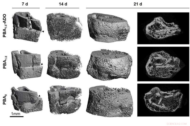 Innovative Bone Bandage Harnesses Natural Healing Biochemical to Speed Recovery