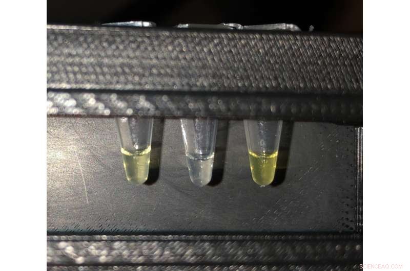 Northwestern’s Rapid Fluoride Test Could Halt Fluoride‑Related Disease