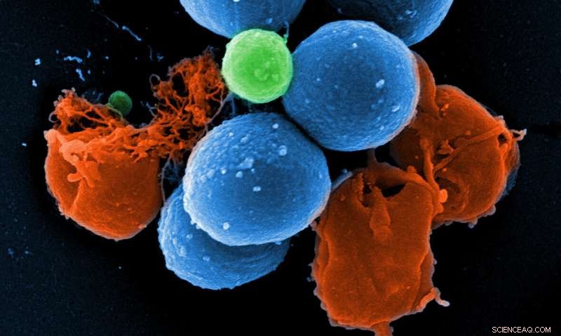 Repurposed Cancer Drug Shows Promise Against Multi-Drug Resistant Bacteria