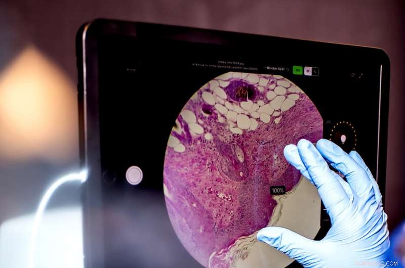 Exercise Enhances Skin Health: Protein Mimics Anti-Aging Effects in Mice