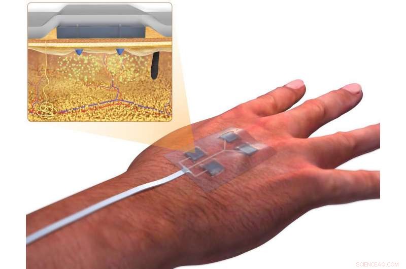 Revolutionary Smart Bandages Developed to Accelerate Healing of Chronic Wounds