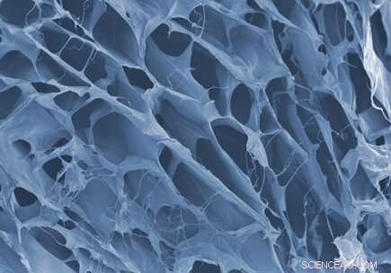 Mussel-Inspired Adhesive Repairs Actively Pumping Heart Muscle