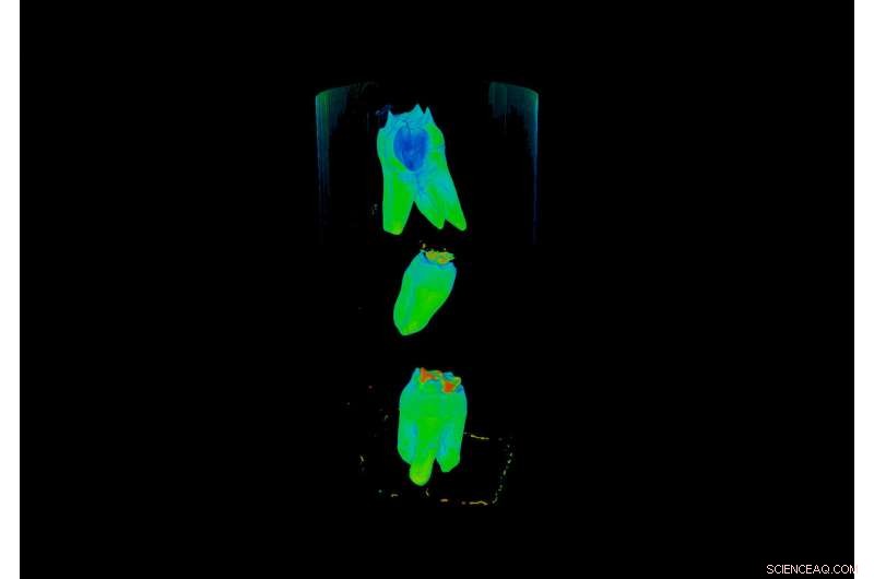 Researchers Leverage Neutron Scattering to Create Affordable, Durable Dental Restorations